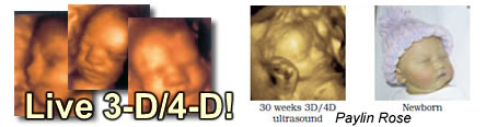 3-D Ultrasounds now available!